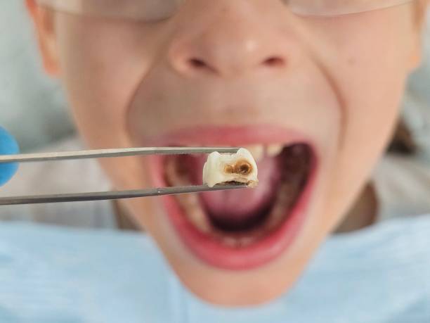 Best Emergency Denture Repair in Bloomsburg, PA
